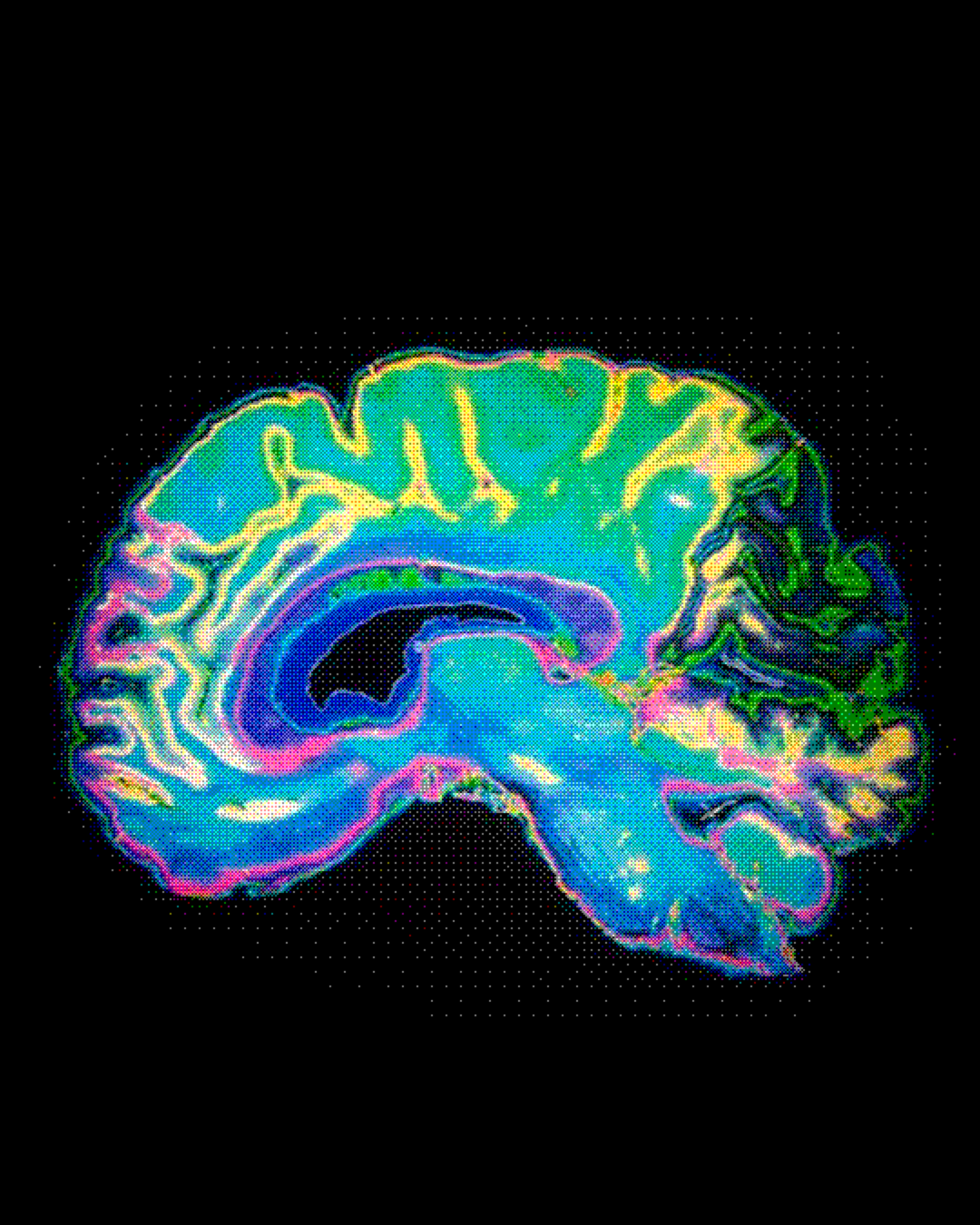 A colorful halftone illustration of a brain in green, blue, yellow and pink against black.